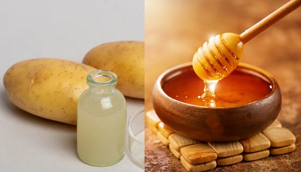 Da thiếu ẩm có thể áp dụng cách làm trắng da bằng khoai tây và mật ong